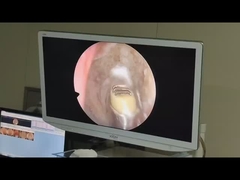 Dispositivo cirúrgico Gerador de plasma de alta frequência de radiofrequência