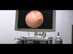 Elétrodo da urologia do sistema da cirurgia do plasma do RF para a hiperplasia prostática benigna